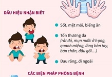 5 tháng năm 2022: Hơn 5.500 ca mắc tay chân miệng, Bộ Y tế cảnh báo dịch gia tăng